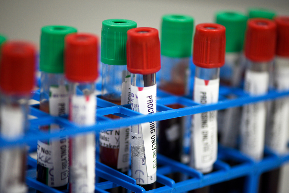 A close-up shot of test tubes in a holder.